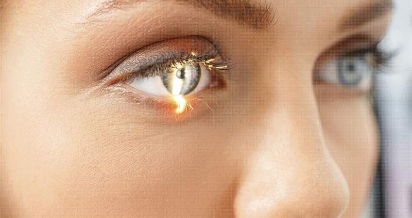 lasik nedir