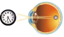 Astigmat olup olmadığımızı nasıl anlarız?