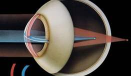 Astigmatizma Neden Oluşur?