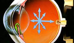 Glokom (Göz Tansiyonu) Nedir?