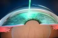 Göz lazer tedavisi ne kadar sürüyor?