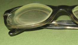 Hipermetropi Neden İlerler?