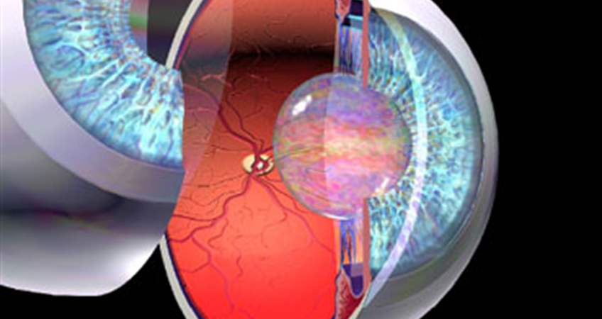 Kaliteli merceğin katarakta yararları nelerdir?