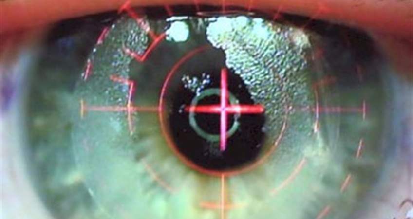 Lasik Göz Ameliyatı Nasıl Yapılır?