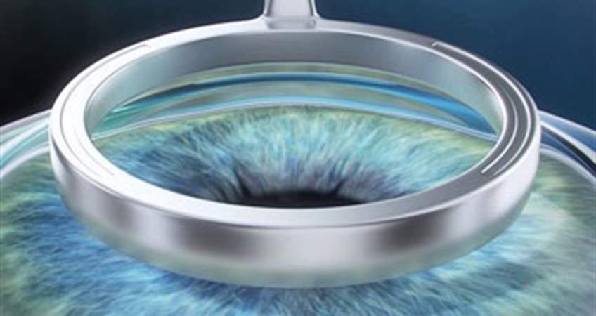 LASEK ve NO-TOUCH Tedavisinin Lasik Yönteminden Farkı