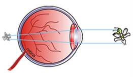 Uzunluk hipermetropisi nedir?