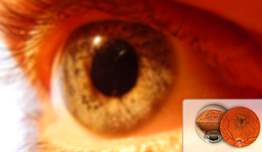 Sarı Nokta Hastalığı Nedir?